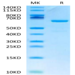 Human CD73/NT5E Protein (CD7-HM173)