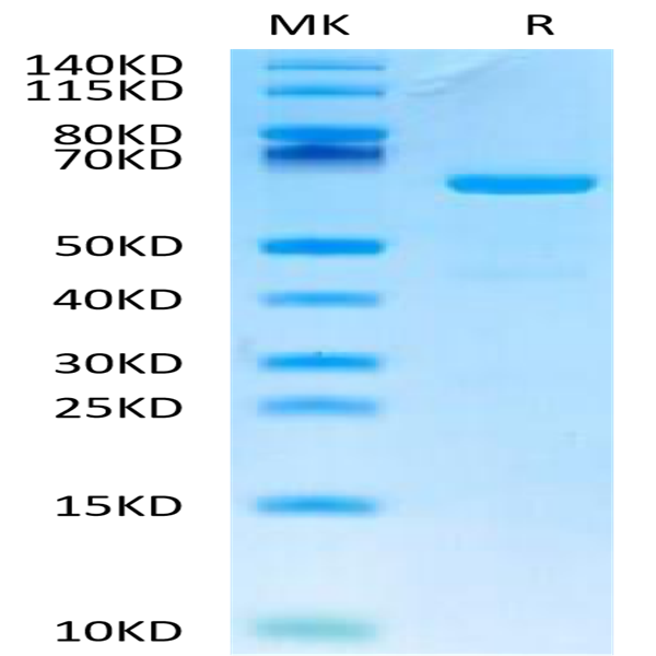 Human CD73/NT5E Protein (CD7-HM173)
