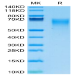 Human IL-17R alpha/CD217 Protein (CD7-HM1RA)