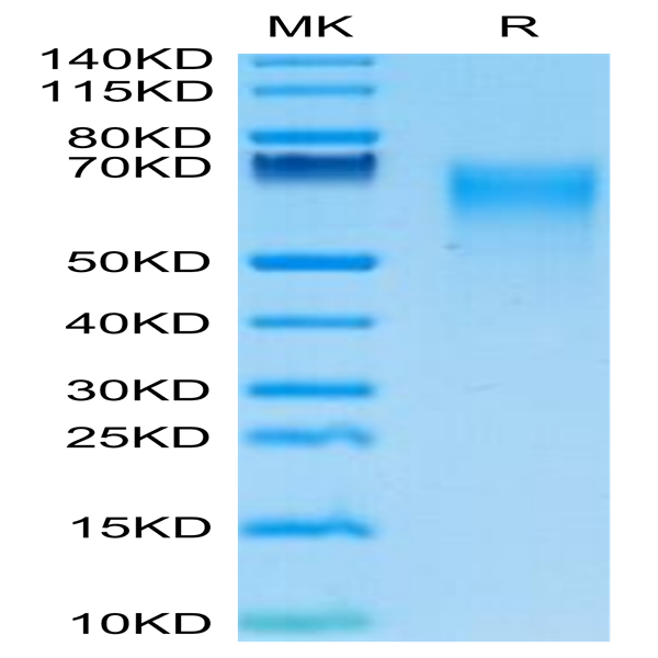 Human IL-17R alpha/CD217 Protein (CD7-HM1RA)