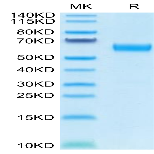 Human CD47 Protein (CD7-HM247)