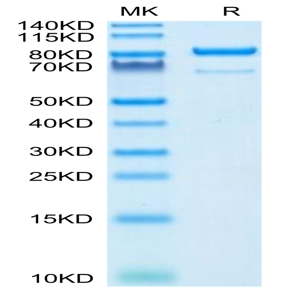 Human CD73/NT5E Protein (CD7-HM273)