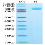 Human IL-17R alpha/CD217 Protein (CD7-HM2RA)