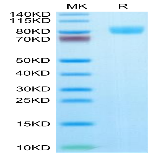Human IL-17R alpha/CD217 Protein (CD7-HM2RA)