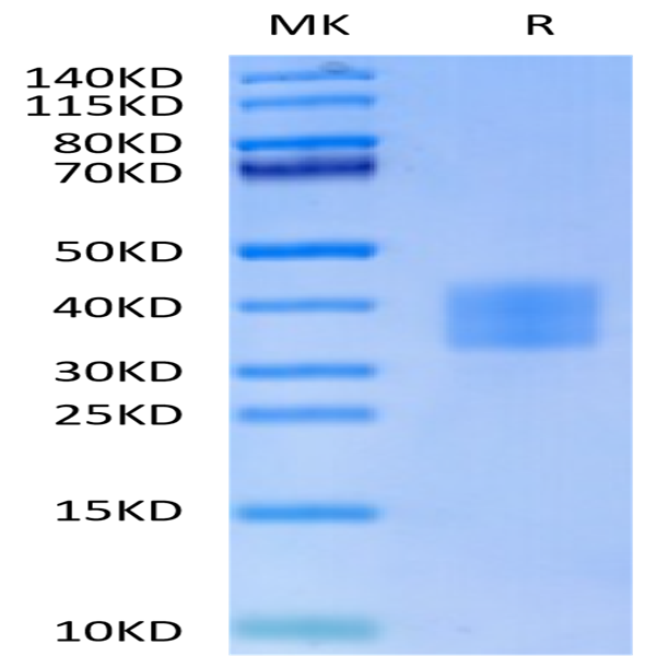 Human CD7 Protein (CD7-HM401)