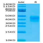 Biotinylated Human CD79B Protein (CD7-HM49BB)