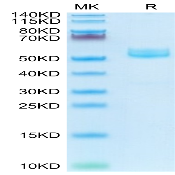 Mouse CD7 Protein (CD7-MM101)