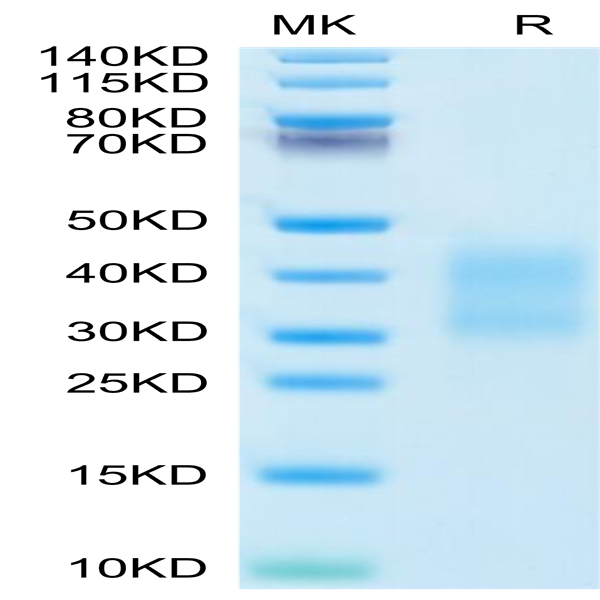 Mouse CD79B Protein (CD7-MM19B)