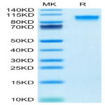 Mouse IL-17R alpha/CD217 Protein (CD7-MM2RA)