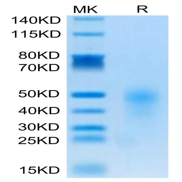 Human CD28H/IGPR-1 Protein (CD8-HM18H)
