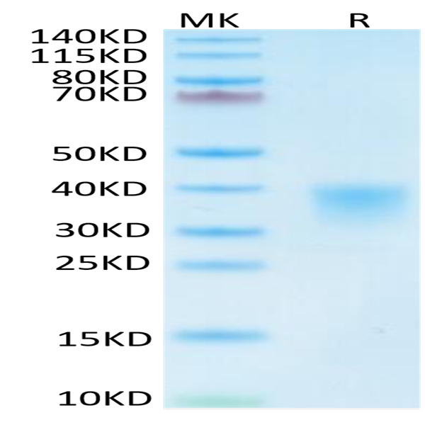 Mouse CD8 alpha/CD8A Protein (CD8-MM18A)