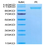 Human CD9P1 Protein (CD9-HM101)