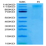 Human CD96/TACTILE (C110S) Protein (CD9-HM19S)