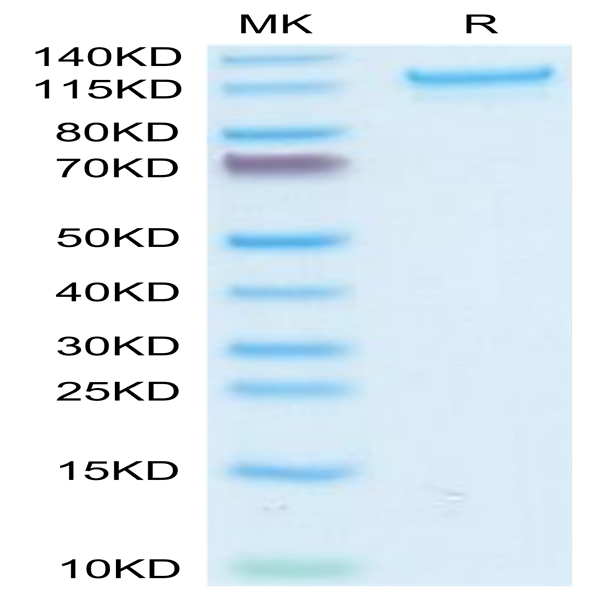Human CD93/C1q R1 Protein (CD9-HM293)