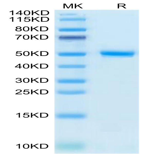 Human CD99/MIC2 Protein (CD9-HM299)