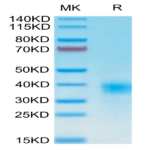 Human CD94 Protein (CD9-HM404)