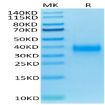 Biotinylated Human CD94 Protein (CD9-HM404B)