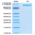 Mouse CD9P1 Protein (CD9-MM101)