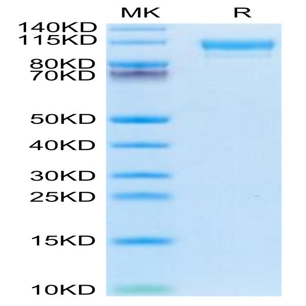 Mouse CD9P1 Protein (CD9-MM101)