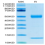 Human CD1A Protein (CDA-HM11A)
