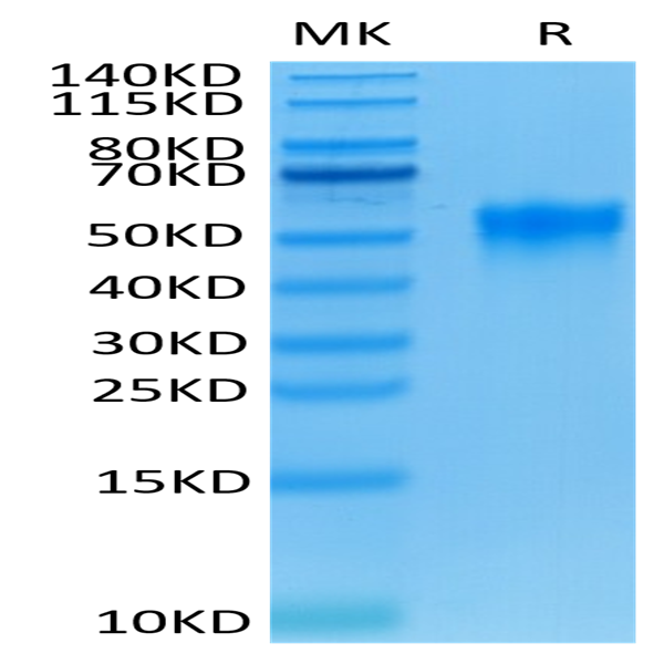 Human Fc gamma RIIIA/CD16a (F176) Protein (CDA-HM416)