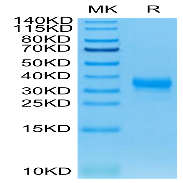 Human Fc gamma RIIA/CD32a (H167) Protein (CDA-HM432)
