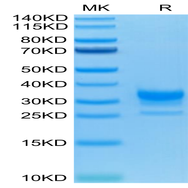 Human Fc gamma RIIB/CD32b Protein (CDB-HM401)