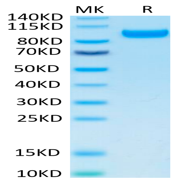 Human CDCP1 Protein (CDC-HM101)