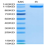 Human CDCP1 Protein (CDC-HM201)