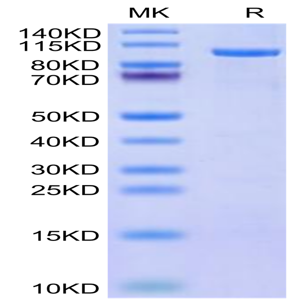 Human CDH19 Protein (CDH-HE019)