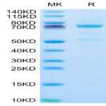 Human CDH3/Cadherin 3 Protein (CDH-HM103)