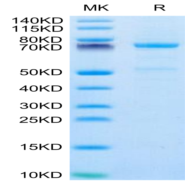 Human CDH3/Cadherin 3 Protein (CDH-HM103)