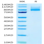 Human CDH6/Cadherin-6 Protein BP003612 Syd Labs