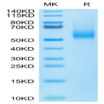 Biotinylated Human CDH17/Cadherin 17 Domain 5-7 Protein BP003609 Syd Labs