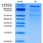 Human CDH6/Cadherin-6 Protein BP003444 Syd Labs