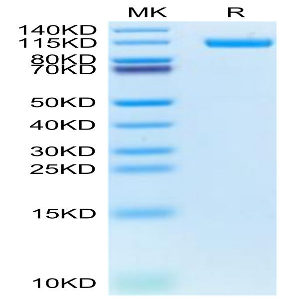 Biotinylated Human CDH17/Cadherin 17 Protein (CDH-HM417B)