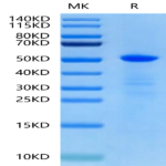 Human CHRDL1 Protein (CDL-HE101)
