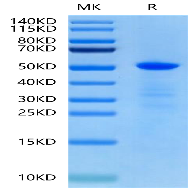 Human CHRDL1 Protein (CDL-HE101)