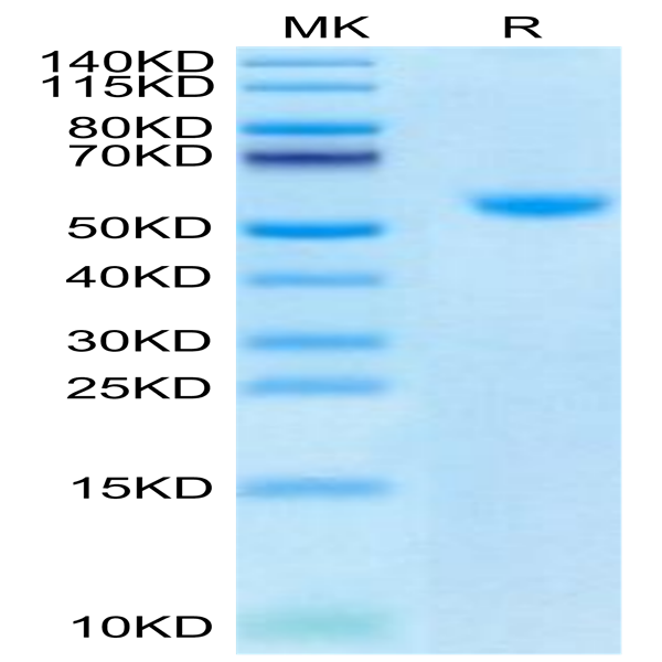 Biotinylated Human CD40 Ligand/TNFSF5 Trimer Protein (Primary Amine Labeling) (CDL-HM140B)