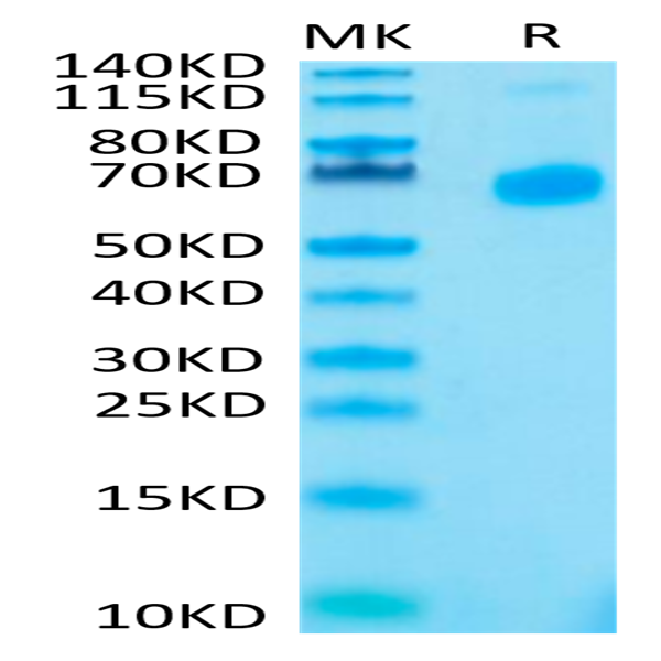 Human CD27 Ligand/CD70 Trimer Protein (CDL-HM427)