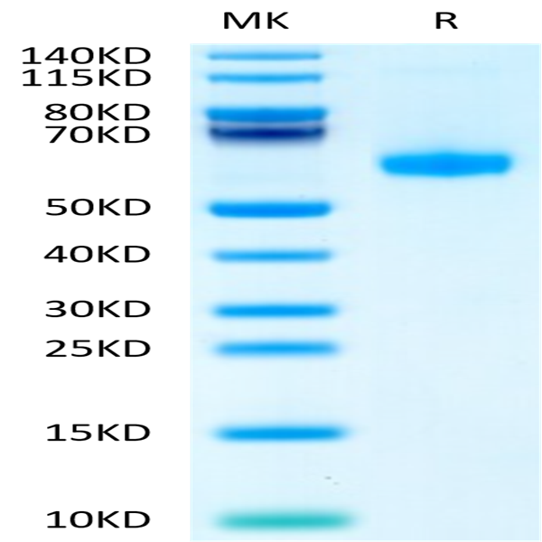 Biotinylated Human CD27 Ligand/CD70 Trimer Protein (Primary Amine Labeling) (CDL-HM427B)