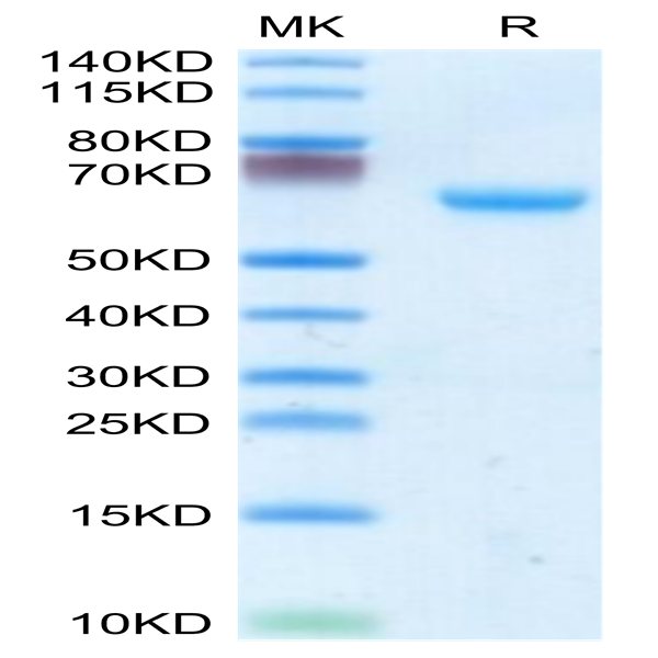 Mouse CHODL Protein (CDL-MM201)