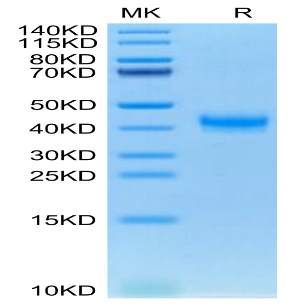 Cynomolgus CADM3 Protein (CDM-CM103)