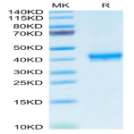 Human CADM3 Protein (CDM-HM103)