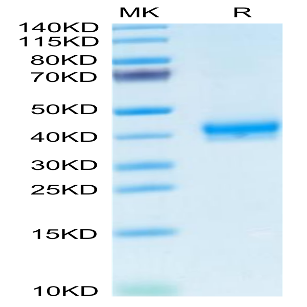Human CADM3 Protein (CDM-HM103)