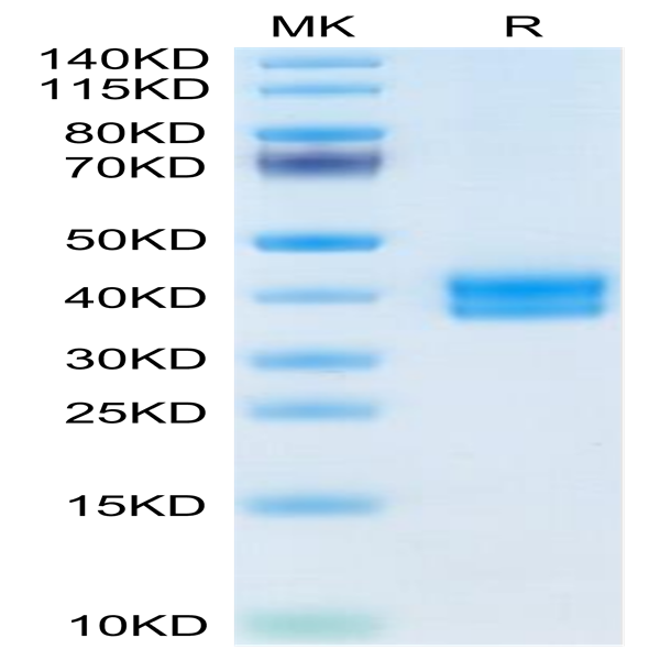 Mouse CADM3 Protein (CDM-MM103)