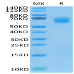 Human CEACAM-8/CD66b Protein (CEA-HM108)
