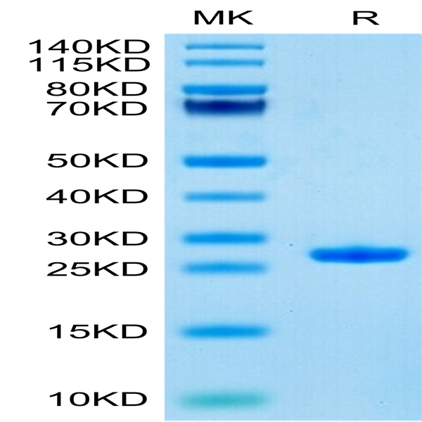 Human Complement Factor D/CFD Protein (CFD-HM101)