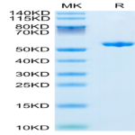 Human Complement Factor D/CFD Protein (CFD-HM201)