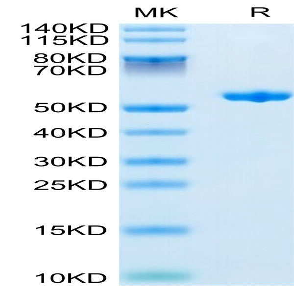 Human Complement Factor D/CFD Protein (CFD-HM201)